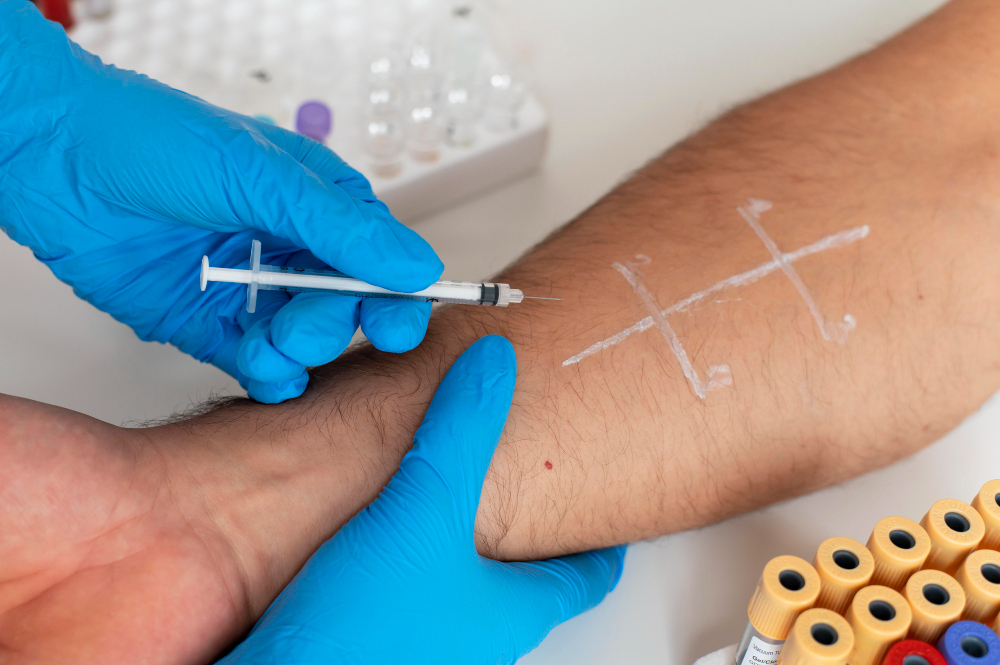 Affrontare le Allergie a Napoli: Il Potere del Prick Test Respiratorio con Pharmatek G.L.M.